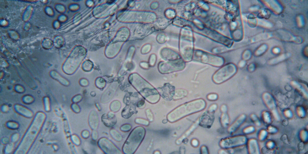 Microorganismos indicadores de contaminación fecal – A tu Salud Microorganismos indicadores de contaminación fecal - A tu Salud