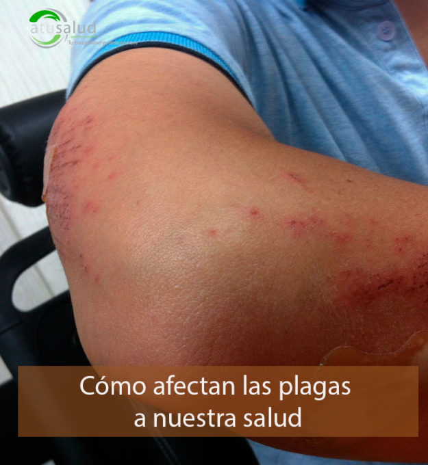 Los peligros de las plagas a nuestra salud