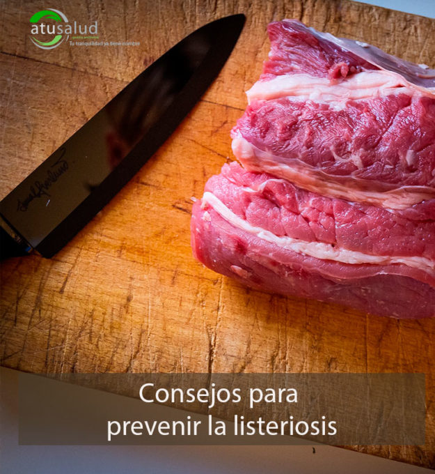 Consejos para prevenir la listeriosis