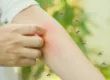 mosquitos controlar plagas en tu negocio